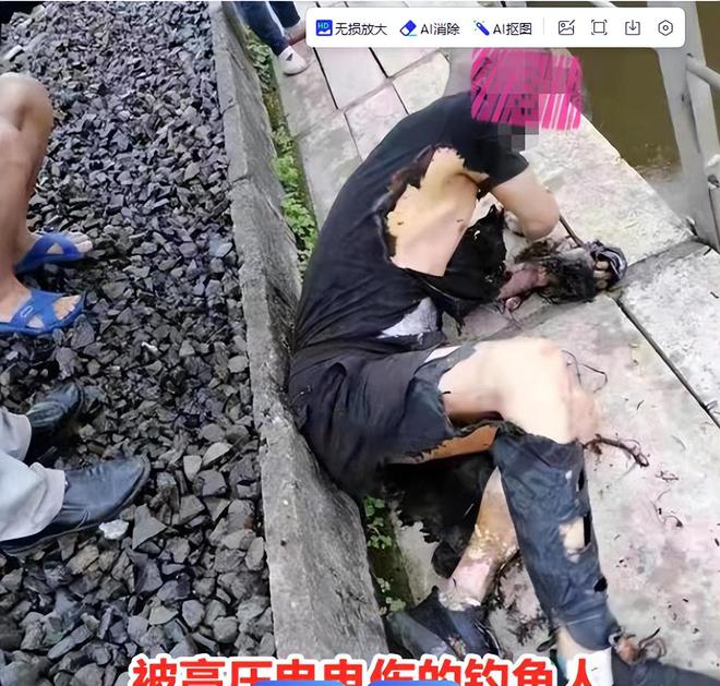 九游娱乐文化：后续！河北男子钓鱼误触高压电瞬间被电冒白烟知情人曝出细节(图10)