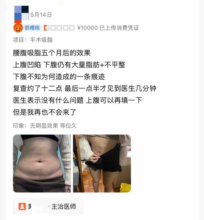 九游娱乐：艺星品牌成投诉“大户”深圳艺星医疗美容医院被记者起底！(图5)