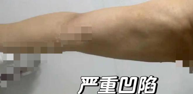 九游娱乐：艺星品牌成投诉“大户”深圳艺星医疗美容医院被记者起底！(图6)